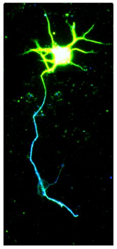 junges Neuron