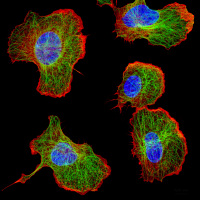 Zellen in Bewegung: Viele Krperzellen bauen ihr Zell-Skelett um - Abwehrzellen des Immunsystems beispielsweise, um auf einen Krankheitserreger gezielt zuzuwandern.