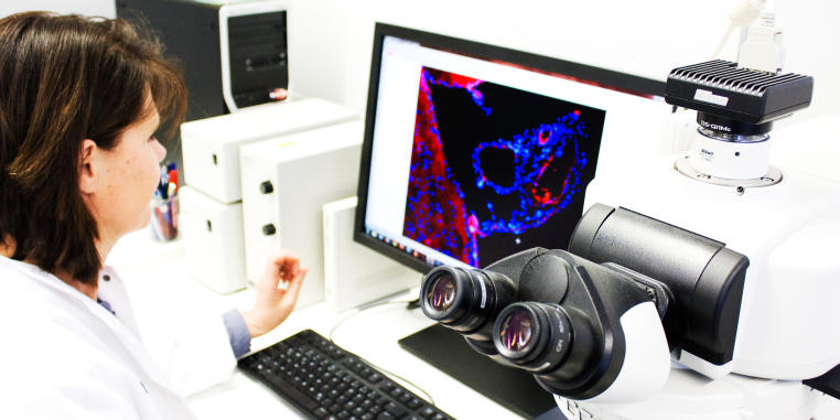 Foto einer Frau, die an einem Computerbildschirm mit Mikroskopiebildern arbeitet