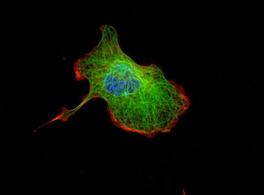 Cell moving to an inflammatory stimulus. Cytoskeletal proteins polarize during migration (actin red, tubulin green, nucleus blue)