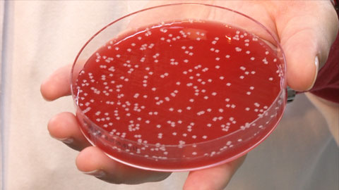Das Bakterium Staphylococcus aureus verursacht nicht nur starke entz&uuml;ndliche Effekte bei einer Infektion, sondern kann sich auch &uuml;ber l&auml;ngere Zeit in den Wirtszellen verstecken. Vor dem Immunsystem und vor vielen Antibiotika gesch&uuml;tzt, k&ouml;nnen die Bakterien zur Quelle f&uuml;r chronische Infektionen werden.