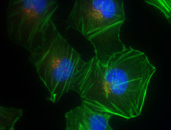 Infektionskrankheiten