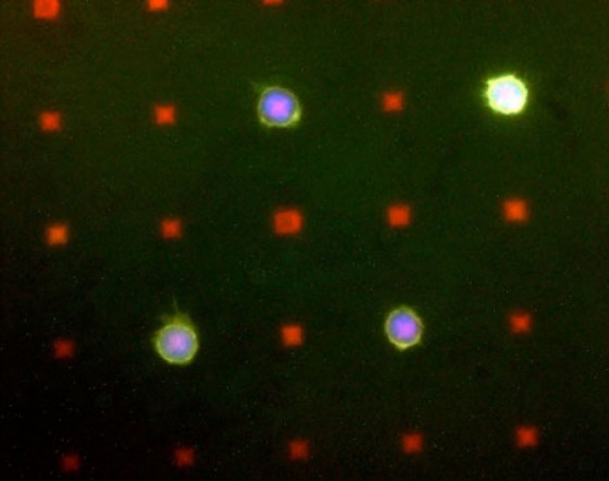Mikroskopische Aufnahme des "aufgestempelten" Oberflächenmusters (rot markiert). Einzelne mit grünem Farbstoff markierte Krebszellen sind hängen geblieben.<address>© Fuchs/Hirtz</address>
