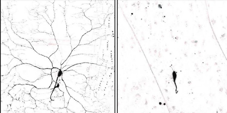 Left: Sensory neuron of a drosophila larva. Centre: In the pupal phase cell processes normally degenerate. Right: Nerve cells lacking the protein PAR-1 exhibit strong dendrite degeneration defects.<address>© Svende Herzmann et al./Embo Journal</address>