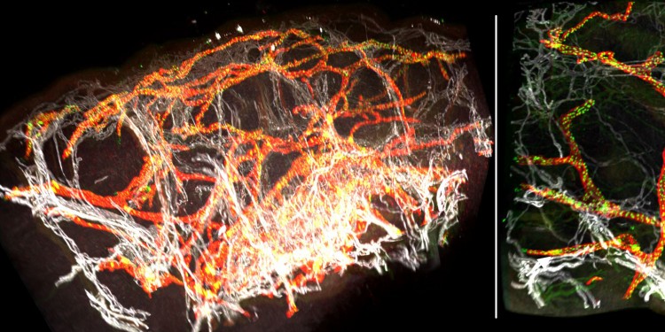 3D computer reconstruction of a healthy human skin biobsy. Spatial arrangement of blood vessels (white) and lymphatic vessels (red) is distinctly visible.<address>© JCI Insight</address>
