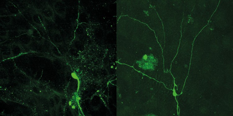 Mikrotubuli (grün) in den Dendriten von Nervenzellen von Fruchtfliegenlarven. Links: Beim Pruning zerfallen die Mikrotubuli zunächst in den Dendriten nah am Zellkörper (dicker Punkt in der Mitte) – es entstehen Lücken. Rechts: Verändert man Mikrotubuli in ihrer polaren Ausrichtung, bauen sie sich nicht mehr richtig ab: Sie sind noch durchgängig zu sehen.<address>© S. Herzmann et al./Development</address>