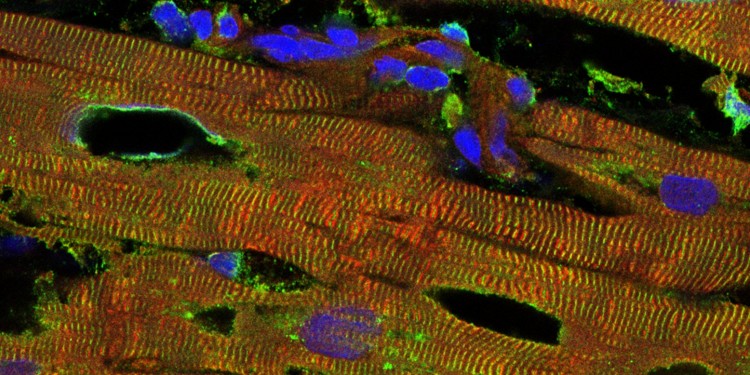 Immunfluoreszenzfärbung des Muskelgewebes eines chronisch erkrankten menschlichen Herzens im konfokalen Mikroskop. Zwei Proteine in den Sarkomeren, die dem Herzmuskel die charakteristische Querstreifung verleihen, wurden mit Antikörpern markiert und durch unterschiedliche Farbstoff-konjugierte Antikörper sichtbar gemacht: Titin erscheint rot und Aktinin grün; die Zellkerne wurden blau gefärbt.<address>© Linke Lab</address>