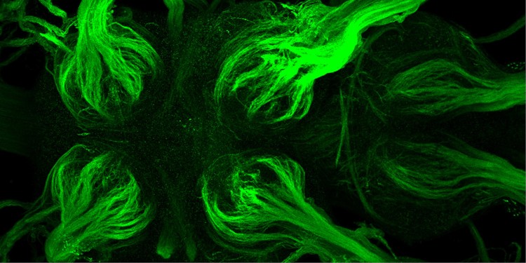 Mikroskopischer Blick in das Nervensystem einer adulten Taufliege. Auf den Axonen der Neurone sind grün fluoreszierende Kanalproteine gezeigt.<address>© WWU - AG Klämbt</address>