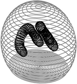 simulated hydrocephalus