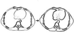 registration of phase fields