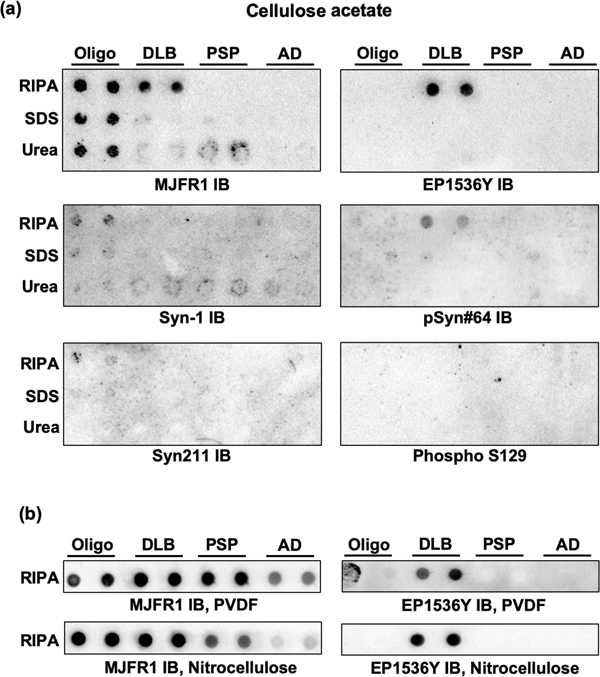 Optimizing filter trap assay for the detection of aggregated alpha