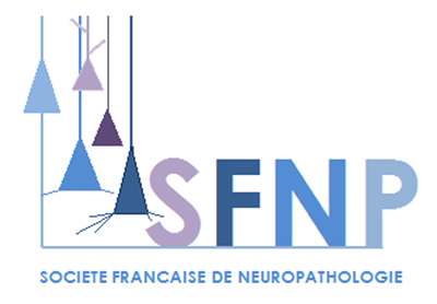 62nd Meeting of the French Society of Neuropathology - Meeting Abstracts