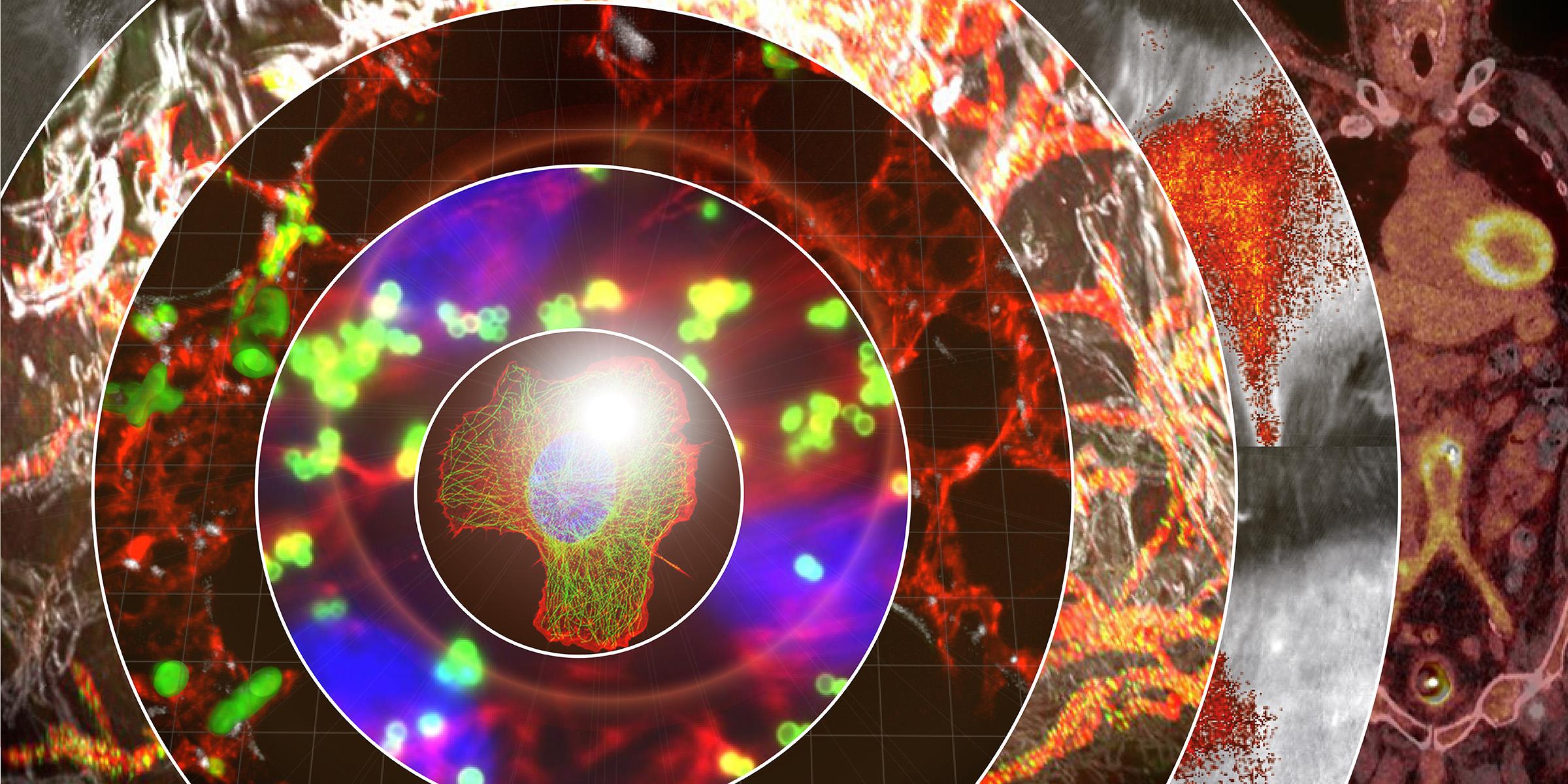 Inflammation & Imaging Lecture