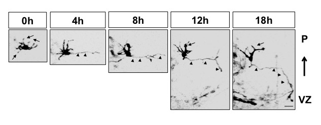Figure 2. Live cell imaging of the MTB transition in cortical slice cultures. 
