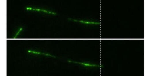 Using TIRF microscopy, Flagella-mediated adhesion can be visualized and analysed. 