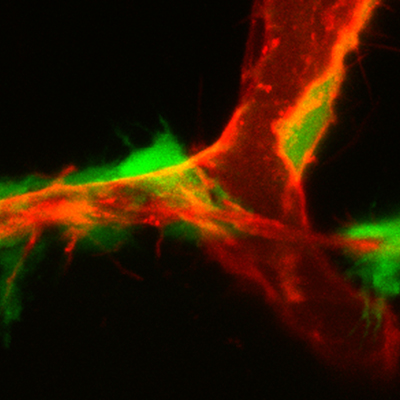 Researchers identify “hot spots” for developing lymphatic vessels