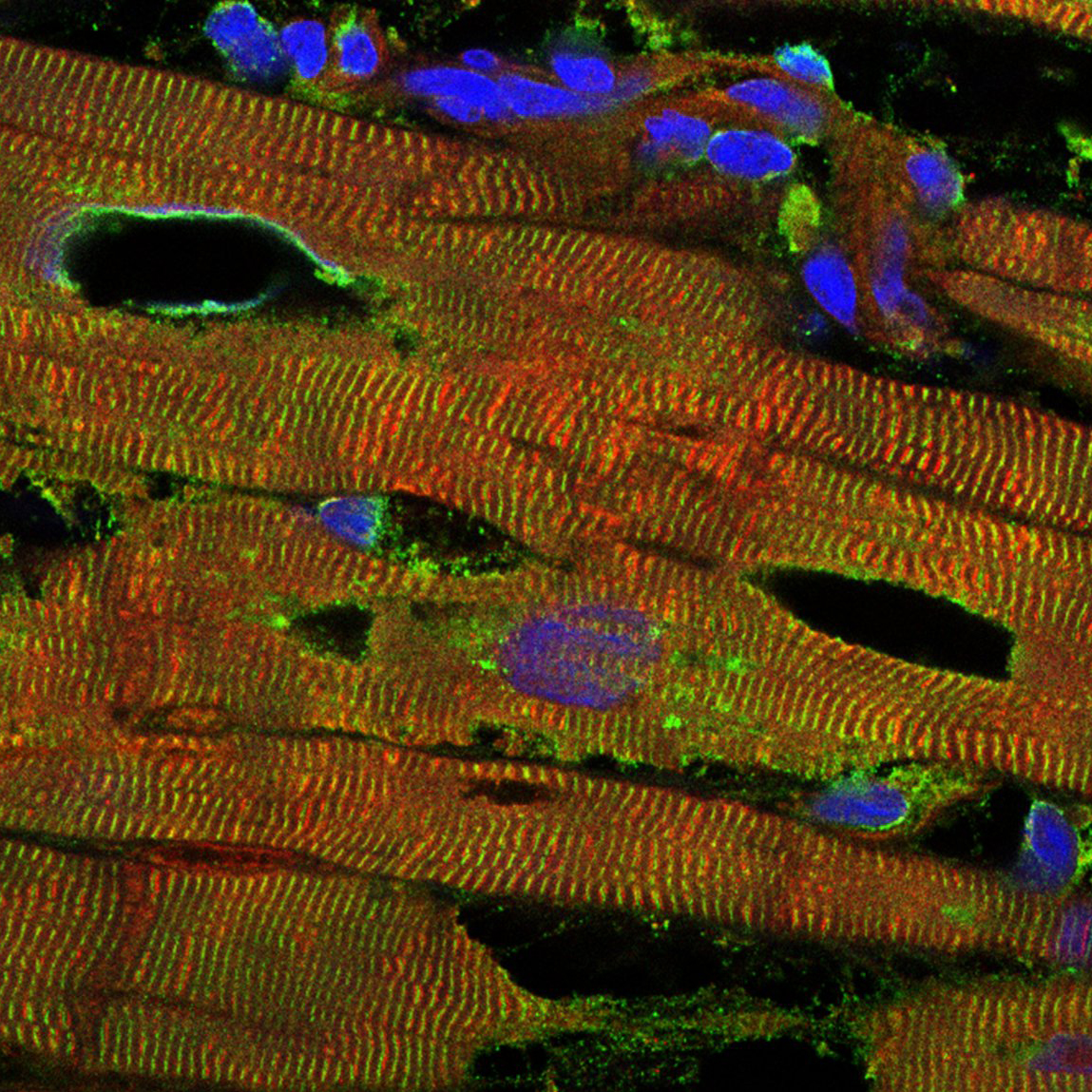 Newly discovered mechanism regulates myocardial distensibility