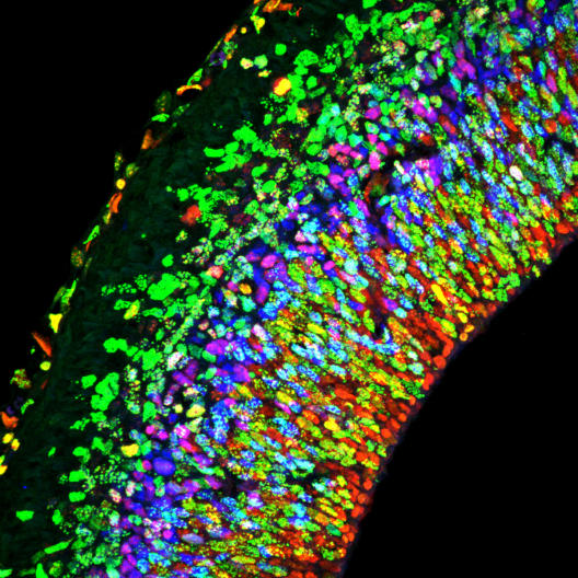 Gewebeschnitt durch die embryonale Großhirnrinde einer Maus: Im Gewebeschnitt sind die unterschiedlichen Zelltypen verschiedenfarbig angefärbt. Dadurch werden die Schichten der Großhirnrinde gut sichtbar.