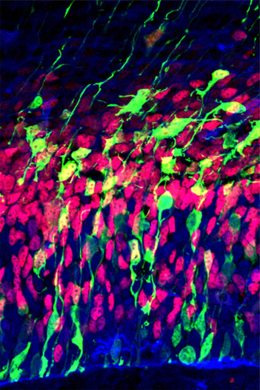 Gewebeschnitt durch eine embryonale Großhirnrinde: Im Gewebeschnitt können Nervenzellen bei der Entwicklung beobachtet werden. Intermediärzellen sind rot markiert. Vorläuferzellen sind blau markiert. Aktiv differenzierende Zellen sind grün markiert.