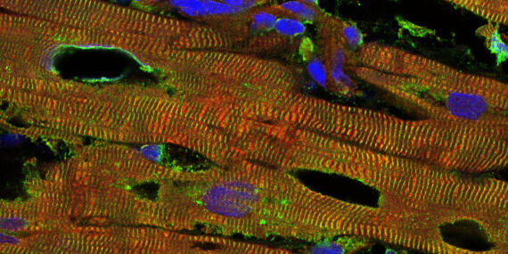Newly discovered mechanism regulates myocardial distensibility