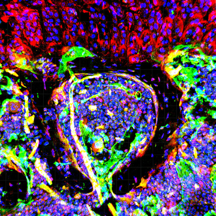 Dieses Bild wurde nicht etwa mit einem Pinsel getupft, sondern mit einem Mikroskop aufgenommen. Es zeigt Zellen in einem Brustbein: Blutgefäßzellen (Endothelzellen, grün) und weitere Zellen (rot) mit ihren Zellkernen (blau). Konfokale Mikroskopie