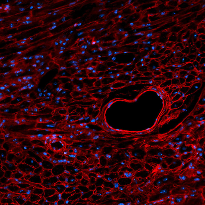 Das Bild zeigt den Querschnitt eines Blutgefäßes im Herzen, das durch die Präparation zufällig Herzform angenommen hat. Im umliegenden Gewebe schimmern die Zellkerne blau. Fluoreszenzmikroskopie