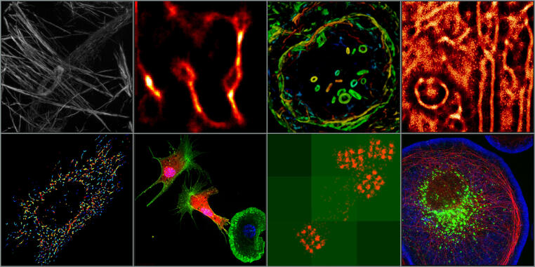 Collage of microscopy images