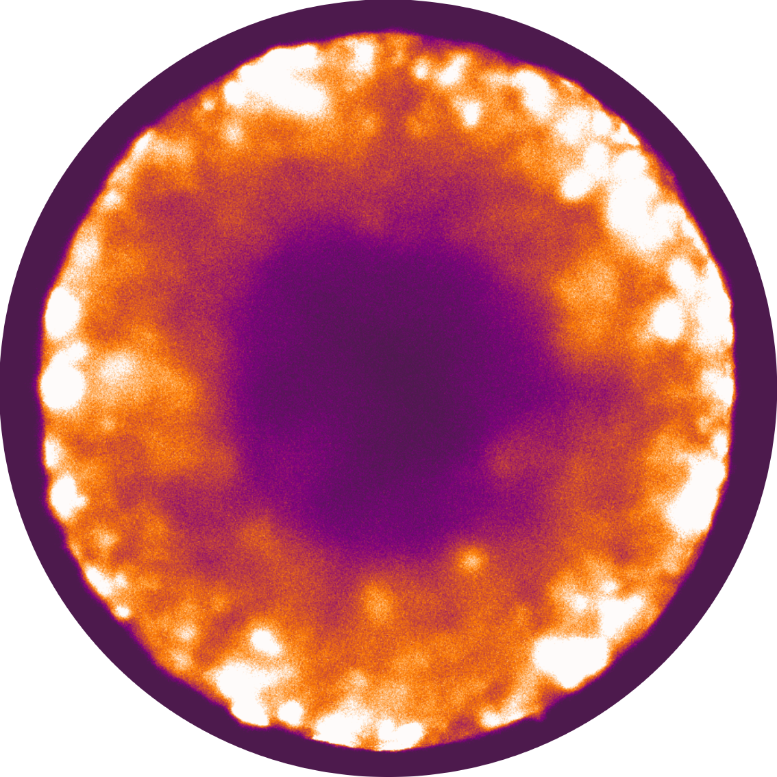 Making processes in the body visible | inVISIBLE