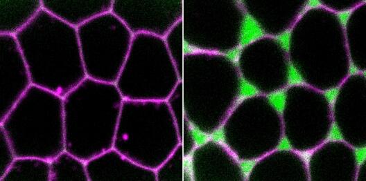 Epithelial cells of a fruit fly egg under the microscope. The cell membrane is stained with a pink dye. Left: At this stage, the cells are tightly connected to each other. Right: At this stage, the cells have loosened their connections and gaps have formed between the cells (stained with a green dye) through which the yolk protein can get to the oocyte.