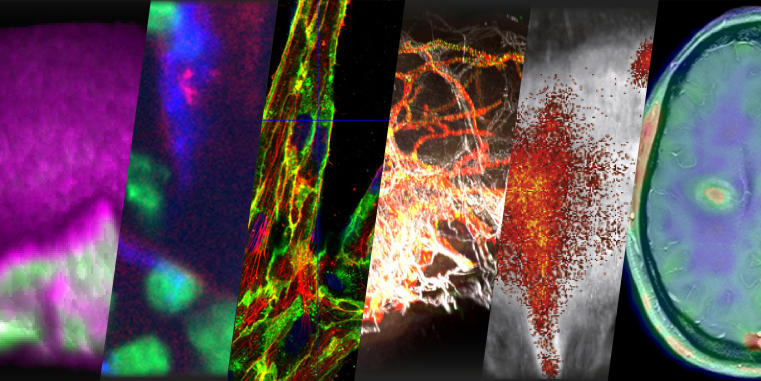Collage of scientific images produced with different imaging techniques