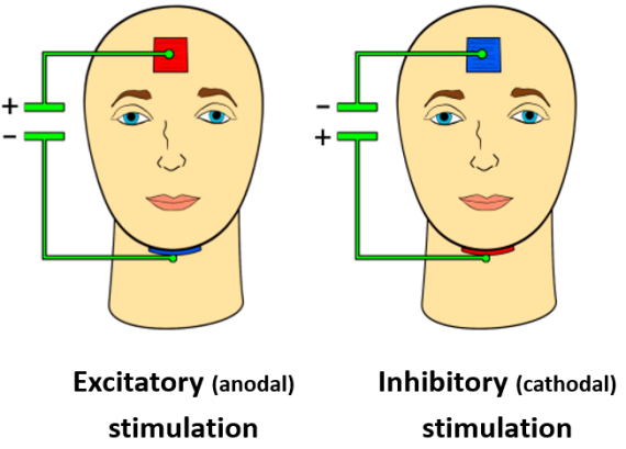 Winker Cerebralcortex 2