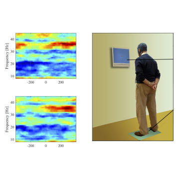 20180502 Maarten Clinical Neurophysiology