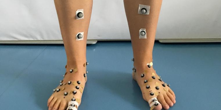 Clinical Biomechanics