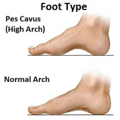 Bsc- Foot Posture Assessment