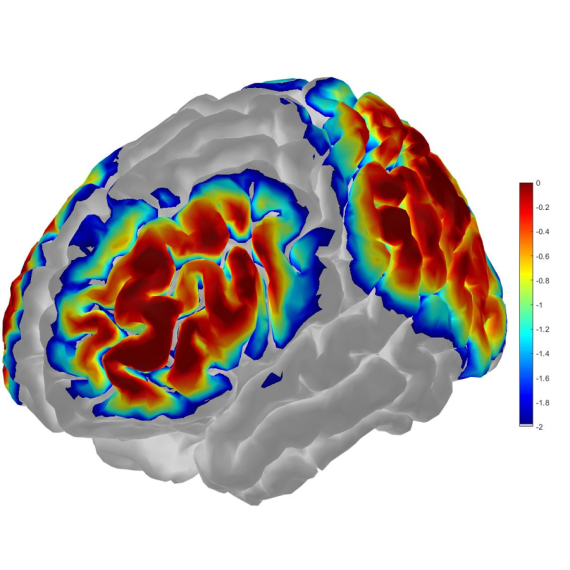 fNIRS brain sensitivity - Monte Carlo Simulation