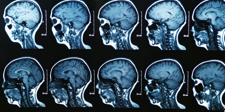 Medical imaging is an important tool for diagnosis and treatment (here: MRT image of a human brain)<address>© colourbox.de/Bunyos</address>