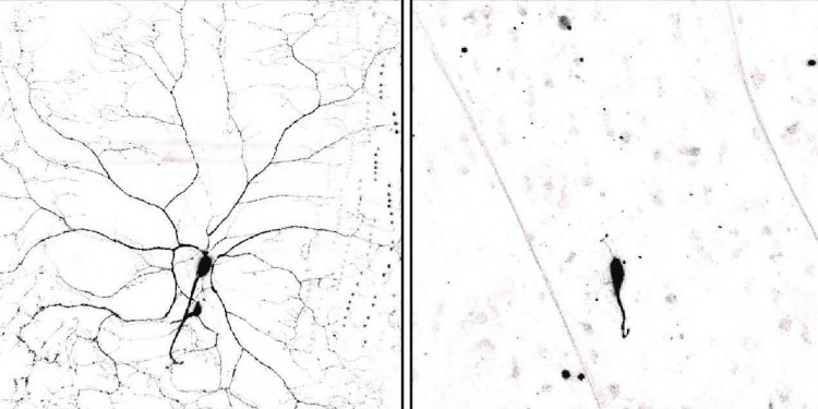 Links: Nervenzelle einer Fruchtfliegenlarve. Mitte: Bei der verpuppten Larve bauen sich die Zellfortsätze im Normalfall ab. Rechts: Fehlt das Protein PAR-1, ist der Abbau der Dendriten gestört.<address>© Svende Herzmann et al./Embo Journal</address>
