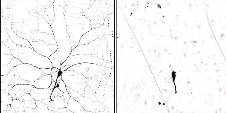 Left: Sensory neuron of a drosophila larva. Centre: In the pupal phase cell processes normally degenerate. Right: Nerve cells lacking the protein PAR-1 exhibit strong dendrite degeneration defects.<address>&copy; Svende Herzmann et al./Embo Journal</address>