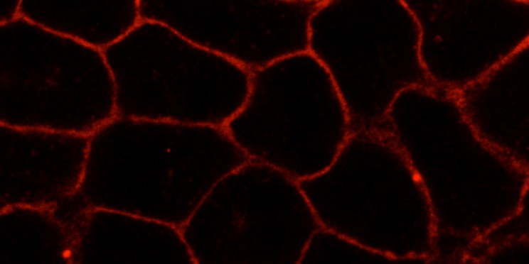 A new compound mimicking natural cholesterol in membranes of living cells (here: HeLa cells). The substance is labelled with a fluorescent dye (red).<address>© L. Rakers et al./Cell Chem Biol</address>