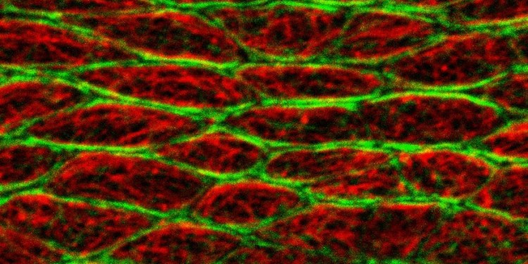 <address>&copy; A. Singh et al./ Nature Cell Biology</address>