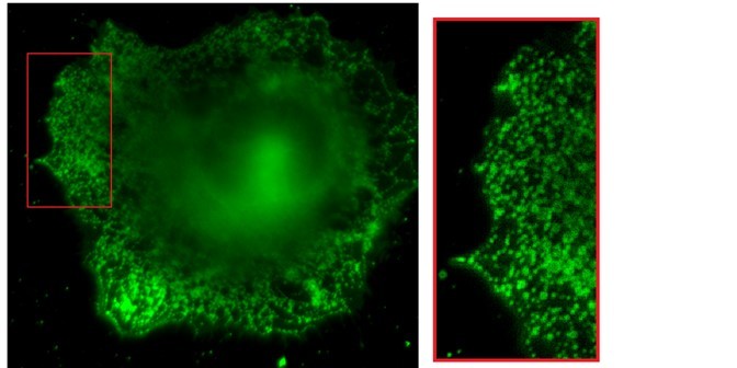 Ionenkanäle einer Tumorzelle, gefärbt mit einer selektiven fluoreszierenden Sonde. Rechts daneben eine Vergrößerung um 300 Prozent.<address>© WWU/Chembion - Kathrin Brömmel</address>