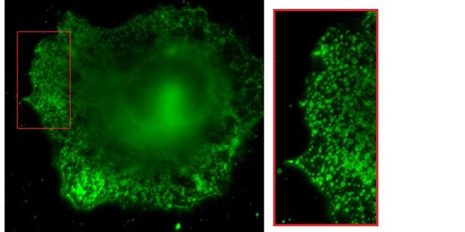 Ion channels in a tumour cell, dyed with a selective fluorescent probe. On the right: a 300 percent enlargement.<address>© Münster University/Chembion - Kathrin Brömmel</address>