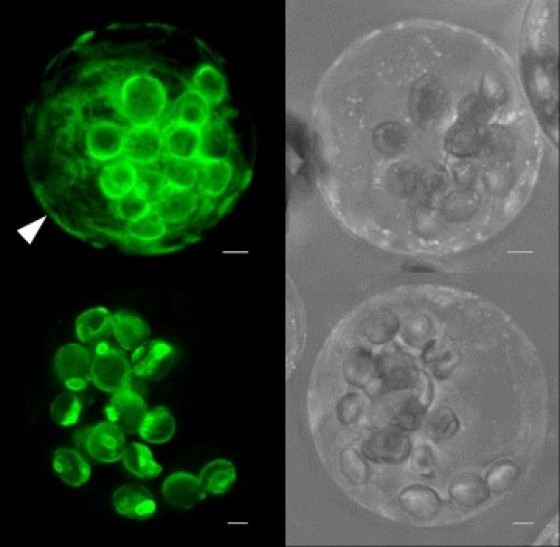 In transfizierten Protoplasten (Pflanzenzellen ohne Zellwand) markieren grün fluoreszierende Fusionsproteine des Membranproteins GPT1 (GPT1-GFP, oben) sowohl Plastiden als auch das Endoplasmatische Retikulum (weißer Pfeil). Bei GPT2 (GPT2-GFP, unten) ist das nicht der Fall.<address>© M.-C. Baune et al. / The Plant Cell / ASBP</address>