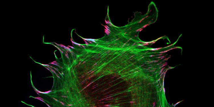 Das Bild zeigt Fokale Adhäsionen (die roten und blauen Bereiche) in Mäusezellen, in denen Metavinkulin eine Verbindung zu dem intrazellulären Aktin-Zytoskelett (grün) herstellt.<address>© Carsten Grashoff</address>
