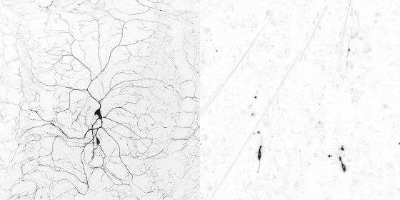 Dendrite degradation of Drosophila neurons during development. Left: A Drosophila larval nerve cell has many branched dendrites. Right: Nerve cells after the degradation of dendrites during metamorphosis.<address>© WWU - AG Sebastian Rumpf</address>