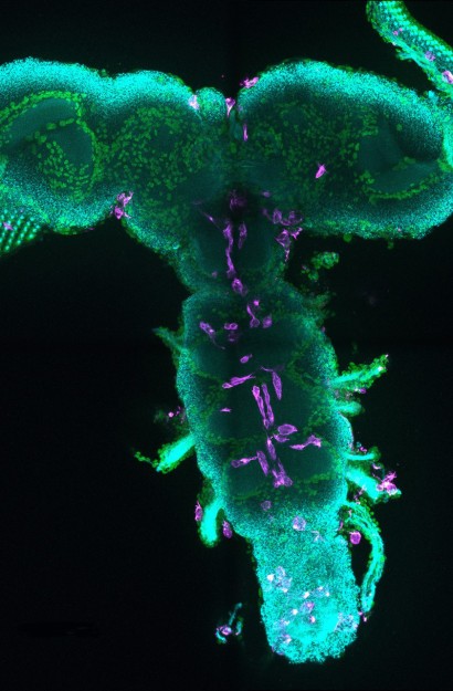 Gehirn einer Drosophila-Puppe mit sichtbarer Immunantwort: Inmitten der Neuronen (cyan) und Gliazellen (grün gefärbten Zellkerne) sind die Makrophagen (magenta) im zentralen Nervensystem erkennbar (Laser-Scanning-Mikroskopaufnahme). © WWU - Bente Winkler und Christian Klämbt