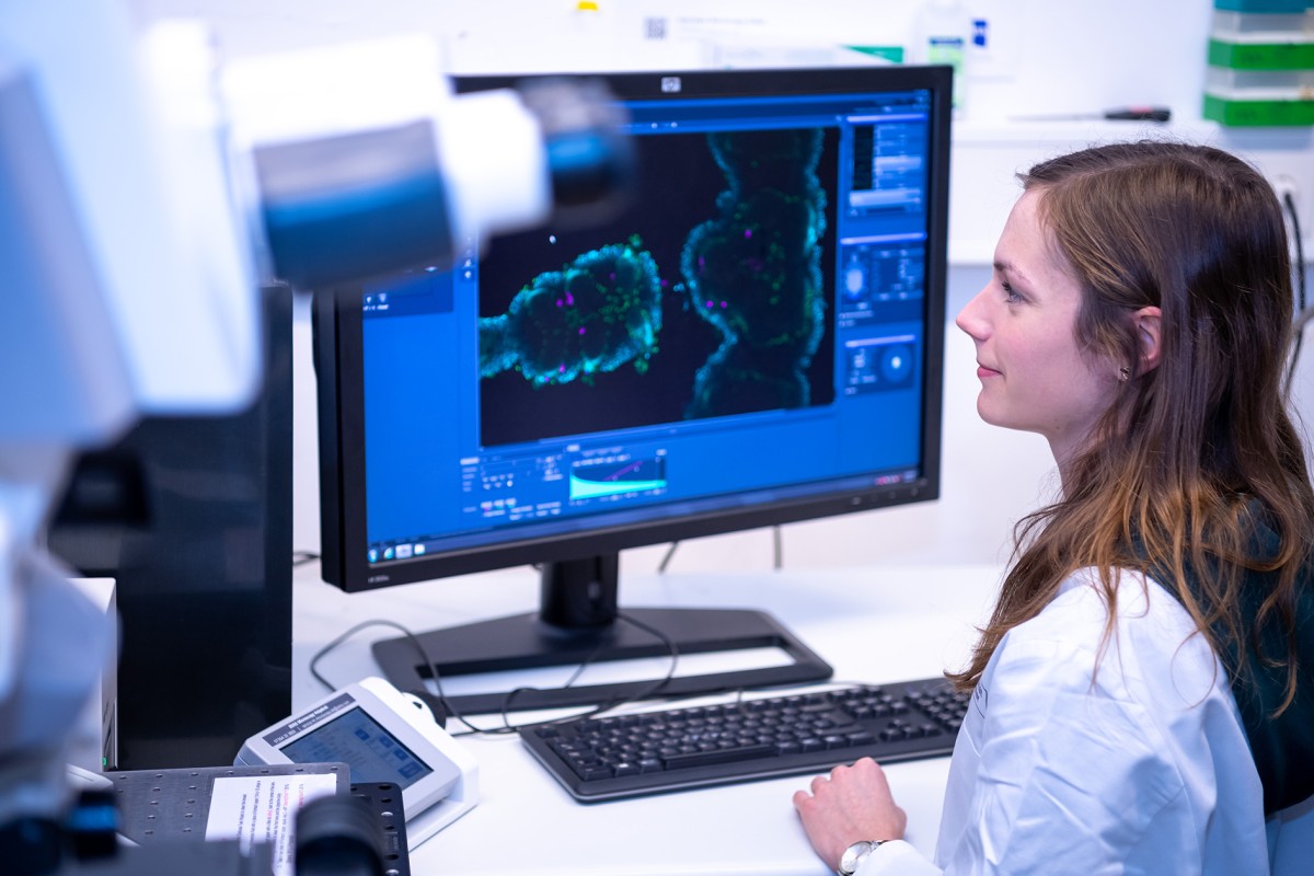 With the laser scanning microscope, Bente Winkler gains insights into the inflammatory processes in the brain in fruit flies.© WWU - Michael Moeller