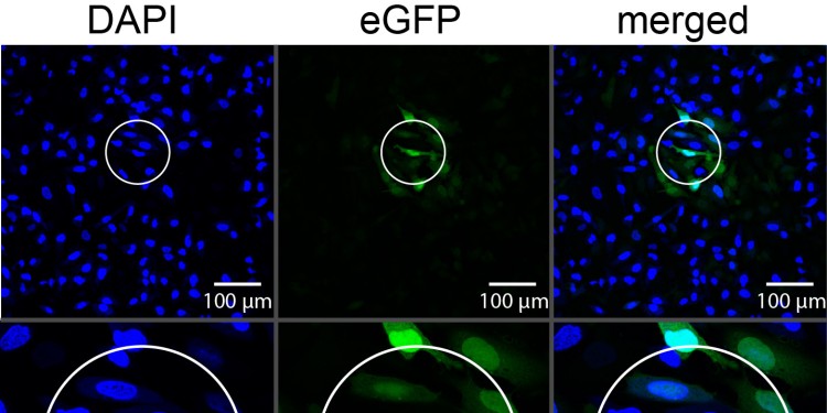 Die Abbildung zeigt die räumliche Kontrolle der Translation von eGFP in HeLa Zellen (menschliche Epithelzellen eines Zervixkarzinoms). Nur die bestrahlten Zellen (innerhalb des Kreises) zeigen grüne Fluoreszenz vom eGFP und deuten damit auf erfolgreiche Translation hin.<address>© AG Rentmeister</address>