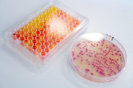 The students can see from the colour whether the bacterial colonies (right) contain the desired genes for monoterpenoid production. The next step then takes place in yeast cells. In the microtitre plate (left), the concentration of the product verbenone is determined by colour assay.<address>© WWU - Michael Möller</address>