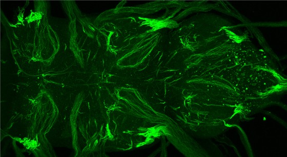 Ausschnitt aus dem zentralen Nervensystem einer adulten Taufliege. Durch einen genetischen Trick sind nur die Kanalproteine auf motorischen Axonen gezeigt.<address>© WWU - AG Klämbt</address>